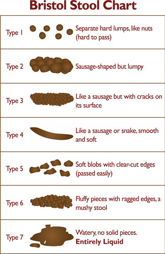 Bristol stool chart graphic